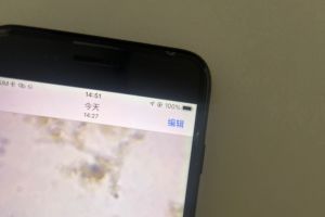 化工污水的第三张镜检