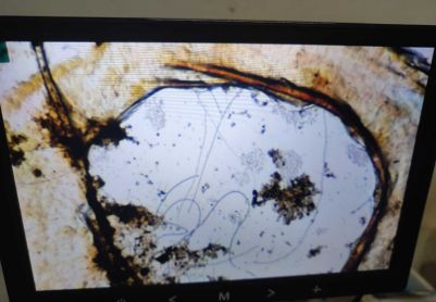 这个正常吗，应该不是丝状菌吧