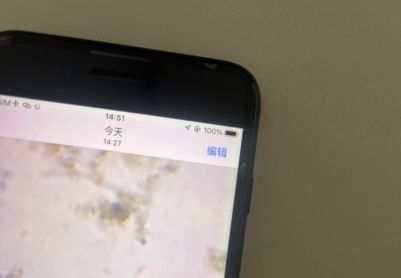 化工污水的第三张镜检