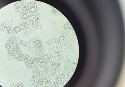 大神们看看，这是啥虫子，近期镜检这个虫比较多。