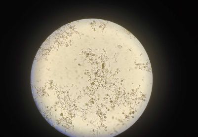 丝状菌膨胀求鉴别！