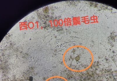 最近鬃毛虫频繁出现，你们的系统里面都有嘛？
