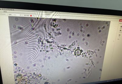 污泥膨胀类型判断