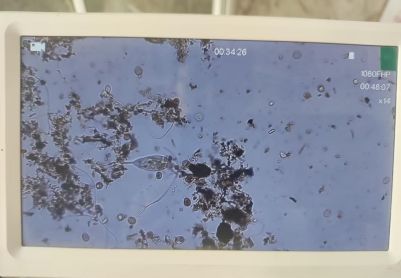 图一图二分别是什么虫