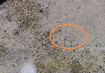 刚启动的系统镜检微生物征兆都不好