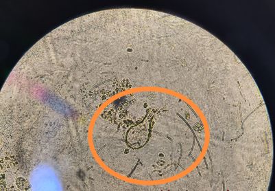 想搞个不一样得镜检，结果结果结果？