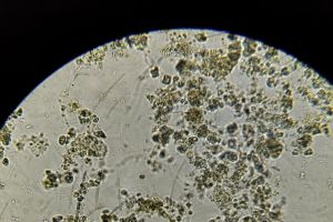 一张镜检图的重要体现