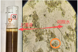 镜检生物相观察宏观和微观现象对应图