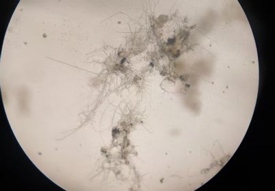 好氧池污泥100倍的镜检图，这种情况是不是很不好，请各位老师帮忙看看