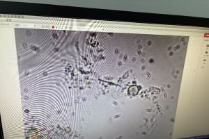污泥膨胀类型判断