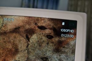 这是什么寄生虫