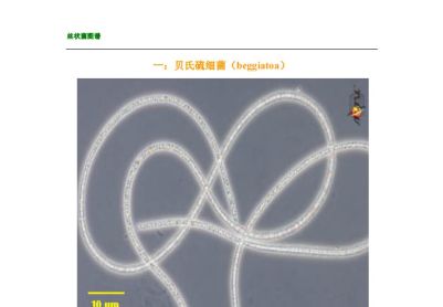丝状菌图谱分享一份供大家参考