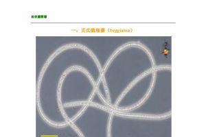 丝状菌图谱分享一份供大家参考