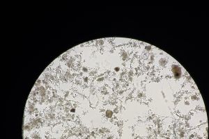 请教各位大佬，这个活性污泥性状正常吗？（10*10观察）