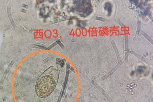 稳定的系统才能看到清晰的微生物