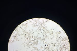 今日污泥镜检，3万吨/天，MBR工艺