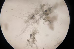 好氧池污泥100倍的镜检图，这种情况是不是很不好，请各位老师帮忙看看