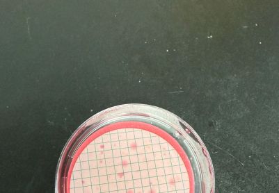 水质粪大肠滤膜法长粉色杂菌