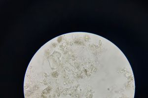 丝状菌是否太多