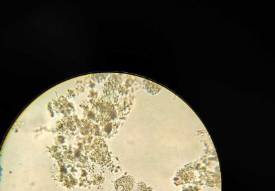 大佬们帮忙看一下都是什么虫