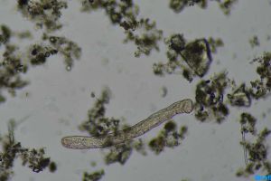 这个是红斑顠体虫吗？