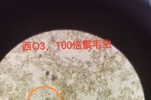 今日镜检鬃毛虫分享