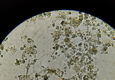 一张镜检图的重要体现