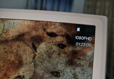 这是什么寄生虫