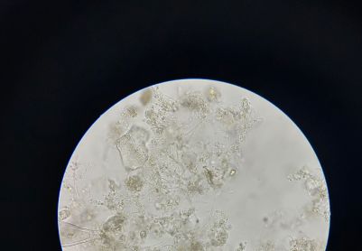 丝状菌是否太多