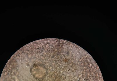 是不是污泥出问题了呢