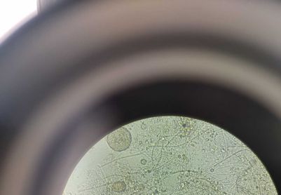 这是污泥膨胀吗