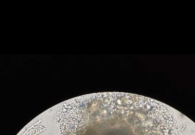 请问这是什么虫虫？