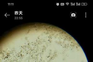 求大神帮看看镜检