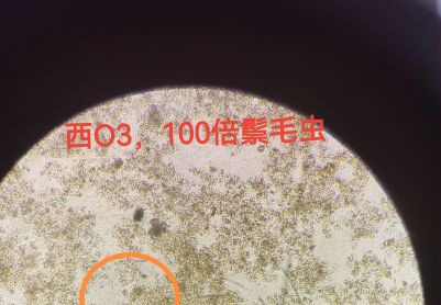 今日镜检鬃毛虫分享