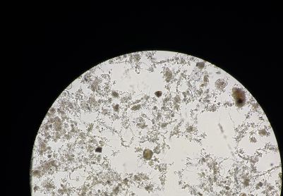 请教各位大佬，这个活性污泥性状正常吗？（10*10观察）