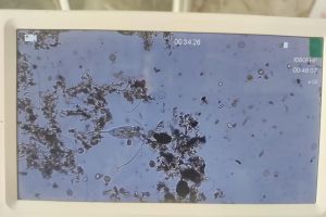 图一图二分别是什么虫