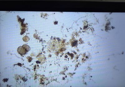 生物池镜检观察