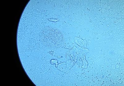 微生物识别，大神们帮忙看看