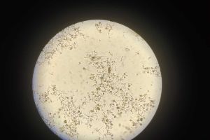 丝状菌膨胀求鉴别！