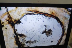 这个正常吗，应该不是丝状菌吧