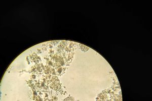 大佬们帮忙看一下都是什么虫