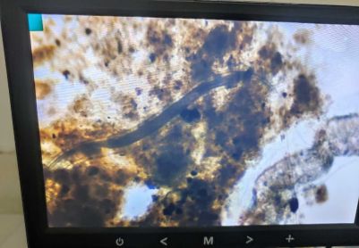 这个有人见过吗是啥东西。