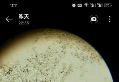 求大神帮看看镜检