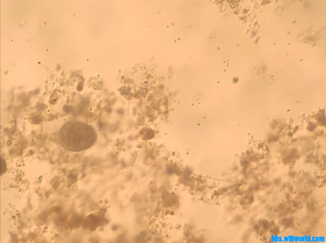 wechat_upload15960812975f224491cf94f