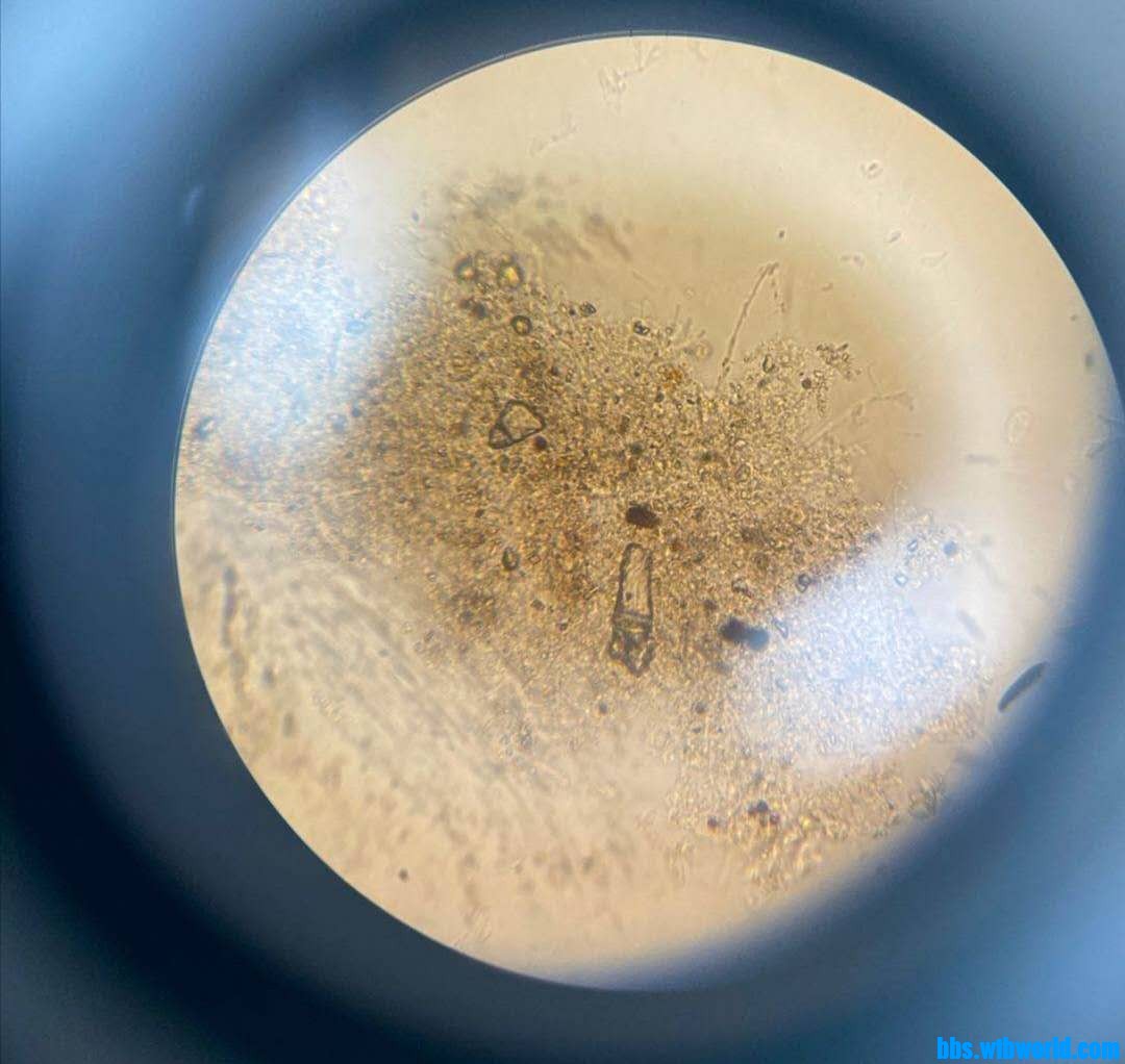 wechat_upload15966000455f2a2eed84e90