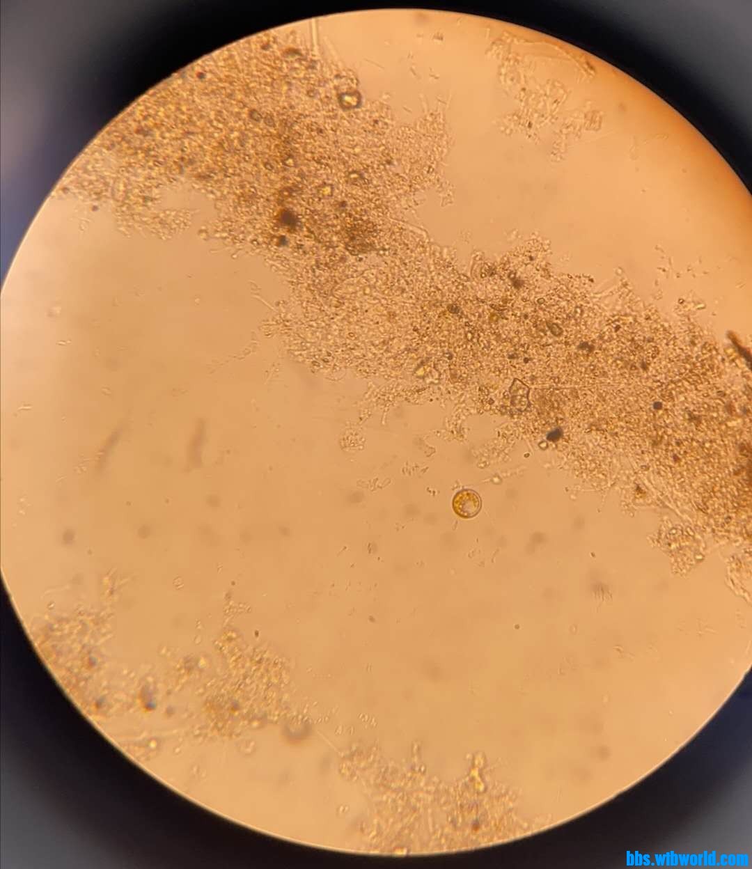 wechat_upload15966002665f2a2fca34745