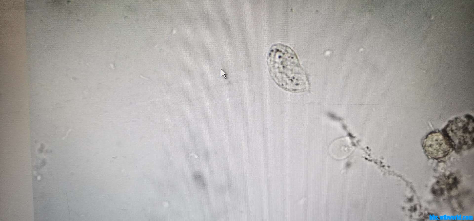 wechat_upload15984075945f45c3aa7a25a