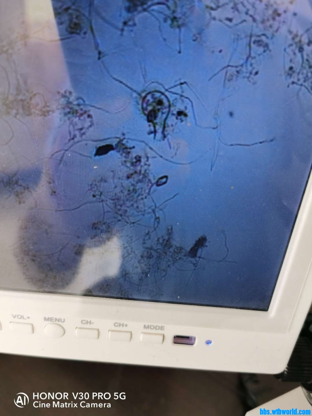 wechat_upload15984205605f45f65093c78