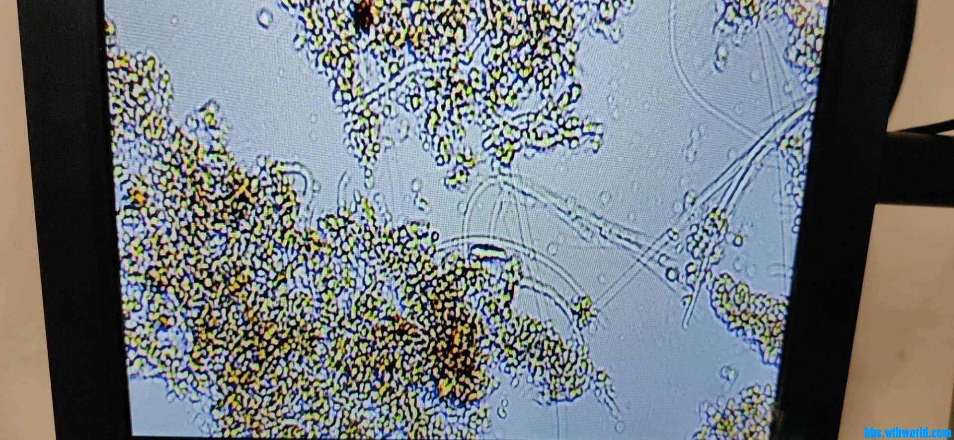 wechat_upload15985087765f474ee858cf6