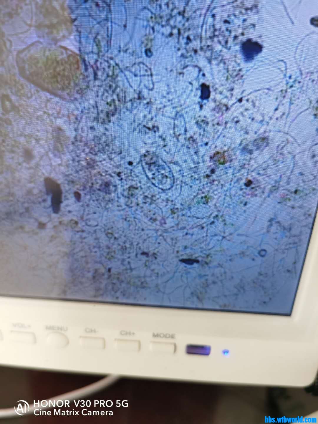 wechat_upload15985134365f47611c48e3b